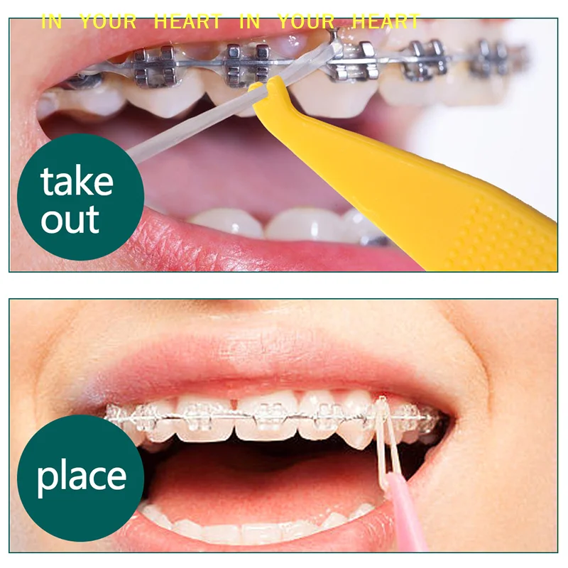【X】10Pcs Dental Orthodontic Elastic Placer For Braces Rubber Bands Placing Hook Ligature Tie Ring Placers Dentistry Accessories view 3