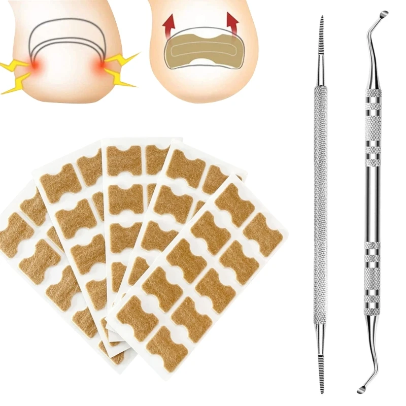 Les patchs correcteurs d'ongles incarnés le tampon remplissage éliminent les ongles ennuyeux, livraison directe