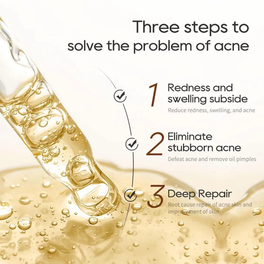 효과적인 심황 세럼, 안티에이징 주근깨 제거, 미백 브라이트닝 세럼, 천연 성분 보습, 부드러운 스킨 케어
