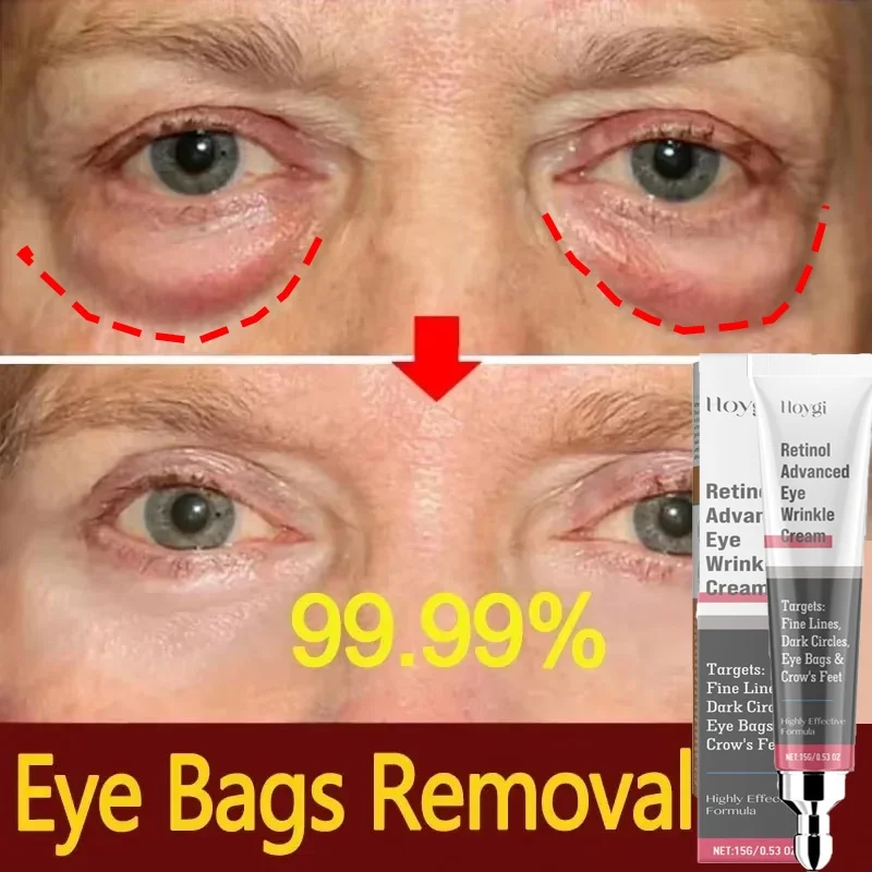 

Instant Eye Bag Removal Cream Retinol Anti-Wrinkle Lifting Firming Fade Fine Lines Anti Dark Circle Puffiness Brighten Eye Care
