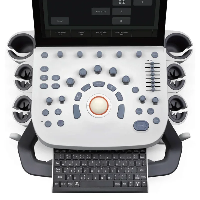 Advanced Sonosite Ultrasound Machine High-Quality White Ultrasound Scanner at Competitive Price