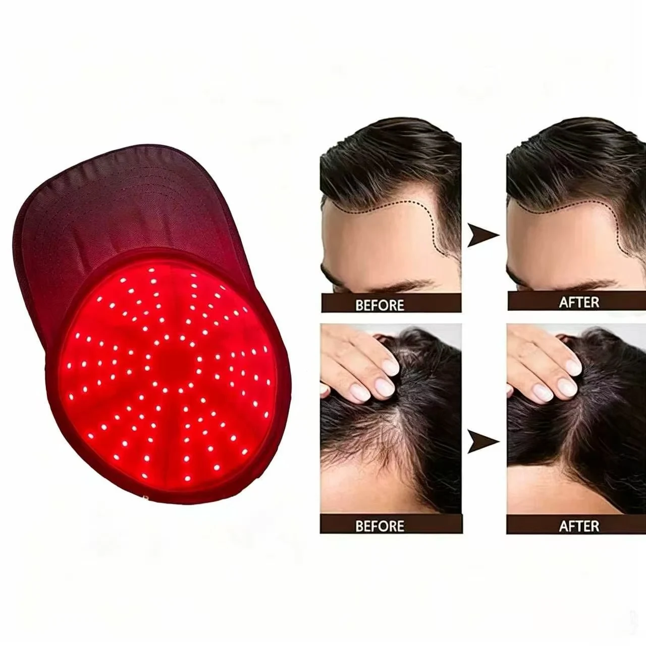 

LLLT Therapy Hair Growth Cap 212 Laser Diodes Anti Hair Loss Treatment Device for Men Women Receding Hair Restore Thickness