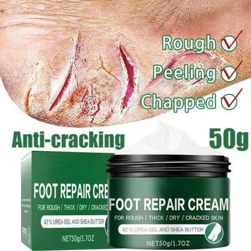 2021 Effective odor treatment nourishing anti cracking cream skin care products dead skin remover chapped Repair Cream