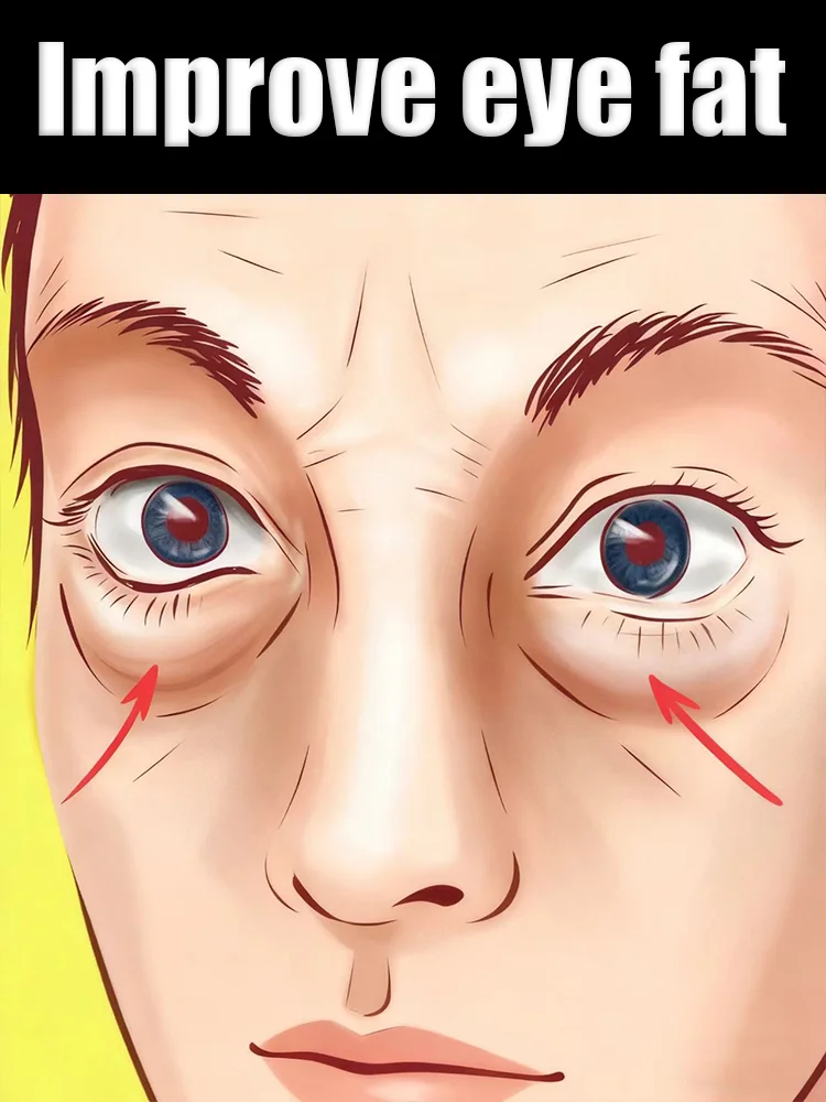 

To improve issues such as tiredness, dark circles, and puffiness around the eyes, apply a cream-based eye cream.