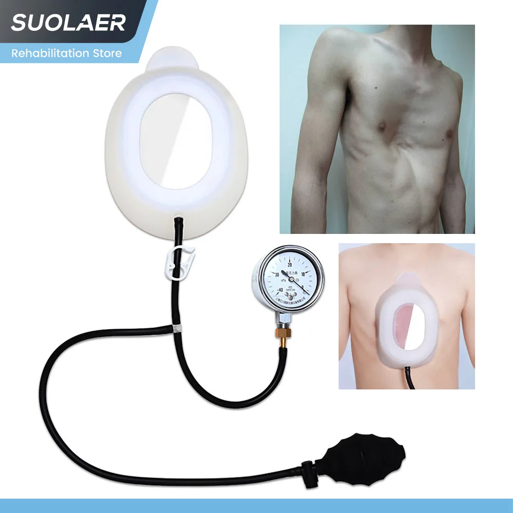 Pectus Excavatum Vacuum Bell Pectus Excavatum Orthosis Brace Sunken Sternum Physical Correction Tool Sternal Depression Support