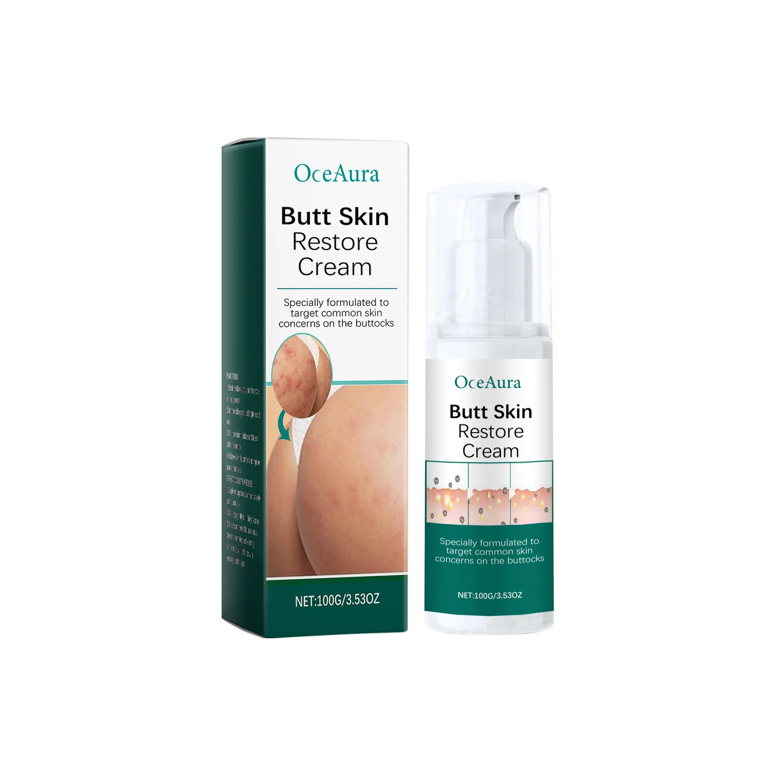 OceAura Butt Acne Cream Chicken Skin Improvement Exfoliator Moisturizing Skin Brightening Products Smooth Skin Treatment Cream