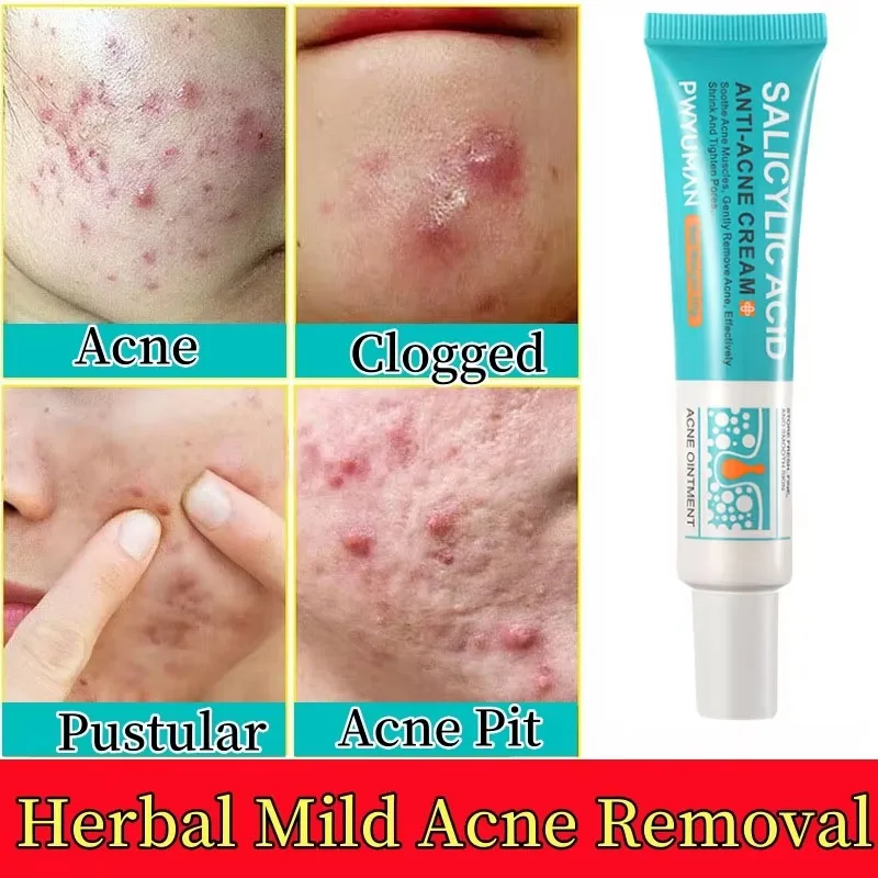 Salicylic Acid Acne Treatment Cream Shrink Pore Remove Blackheads Scars Acne Marks Spots Oil Control Whitening Korean Skin Care