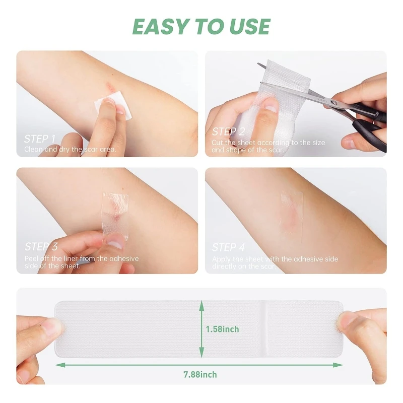 Mebak Silicone Scar Repair Sheets EffectiveC-Section Scar Patch Treatment Strips Reusable Therapy Patch Burn Acne Scar Skin Care