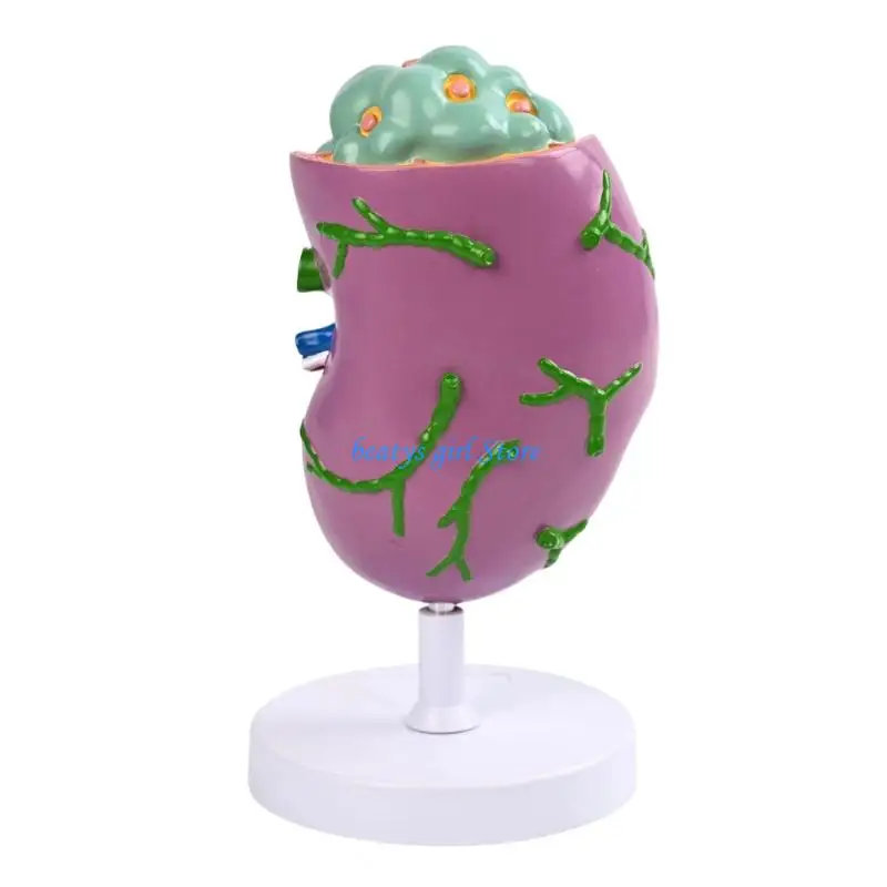 C7AB Human Lymph Node Anatomy Model Anatomical PVC Lymphatic Structure Model for Immunology Study and Clinical Education