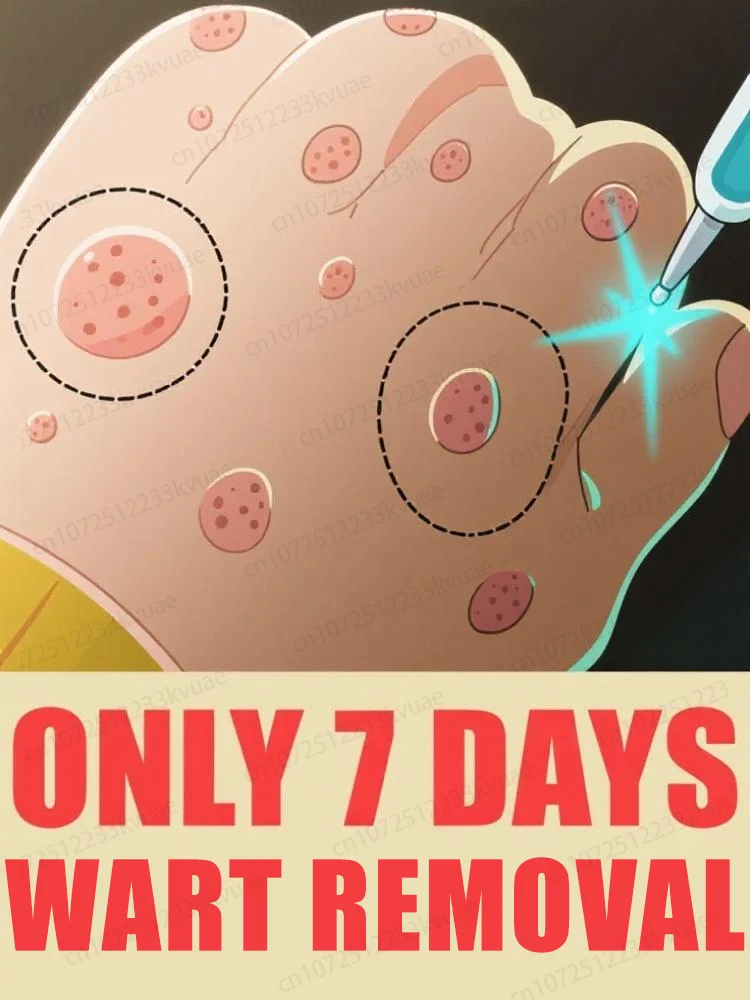 

Tech Revolution Wart Removal Blue Light Pen