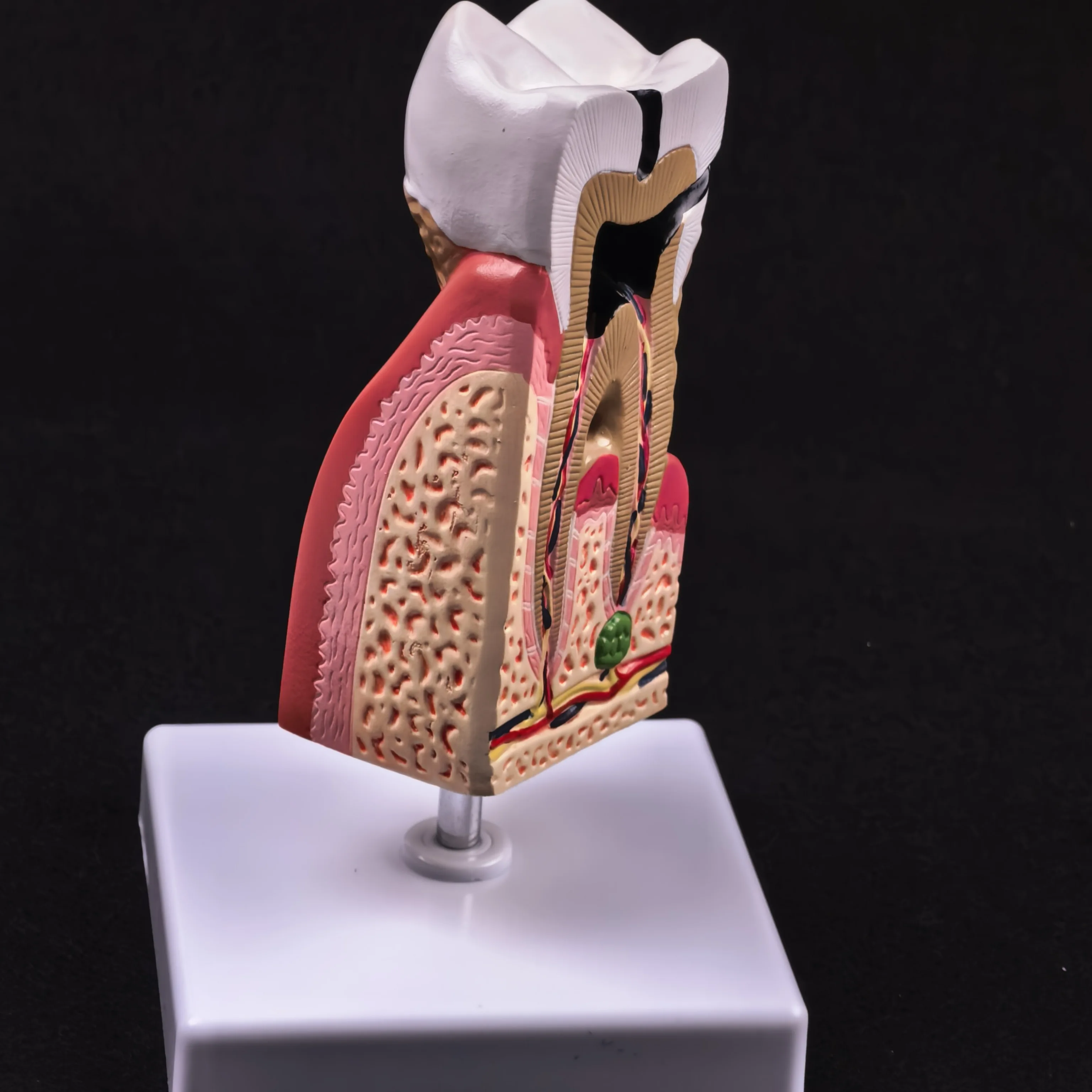 Anatomia médica do modelo anatômico dos dentes malezas humanos do PVC para a educação do paciente