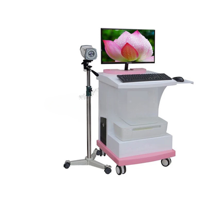 Electronic colposcopy high-definition 2 million pixel gynecological examination