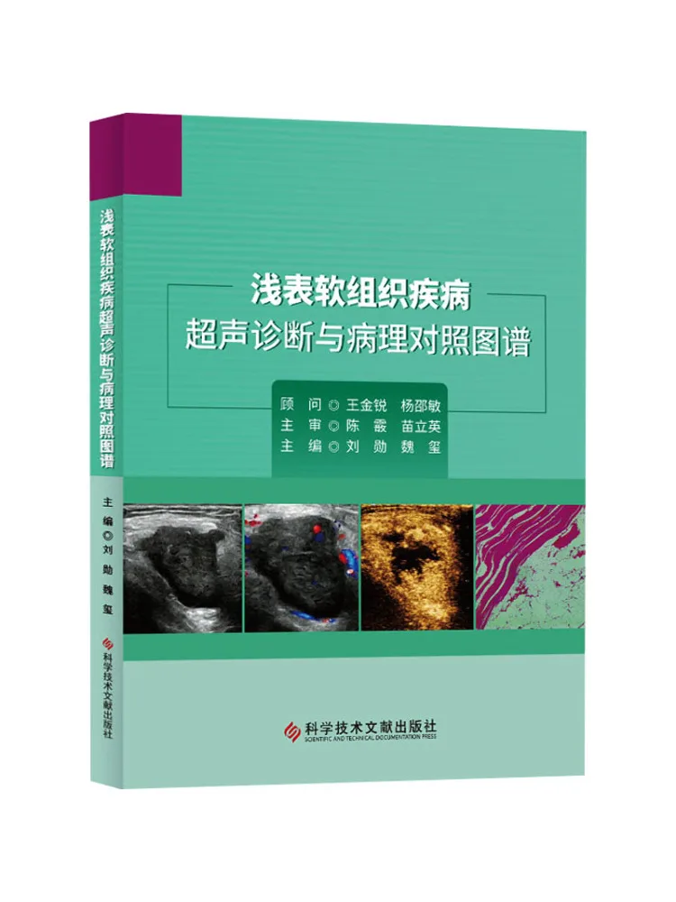 

Book-Winshare Ультразвуковая диагностика и патология Сравнение диаграммы искусственных заболеваний мягких тканей