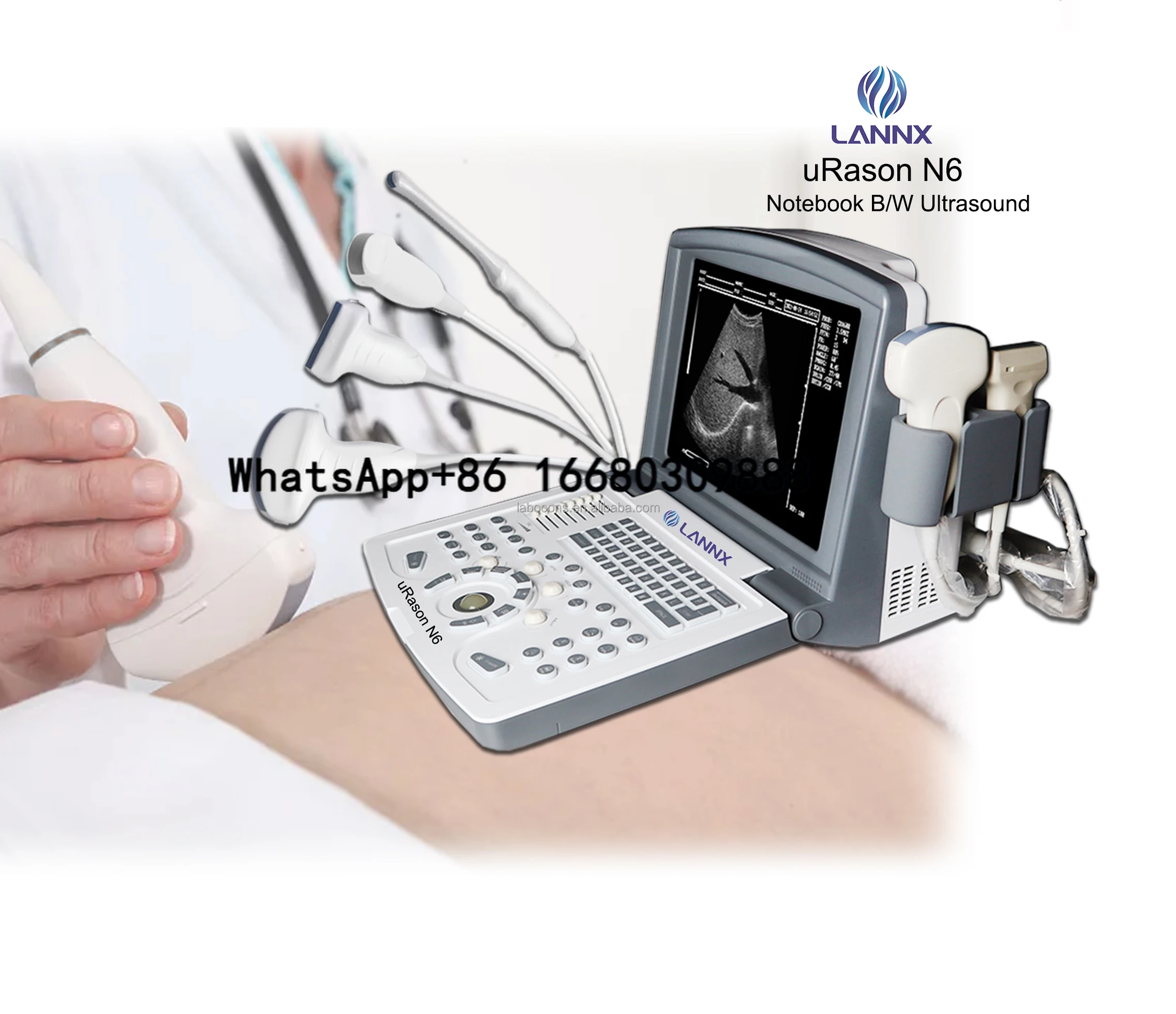 

LANNX URason N6 Well Designed Gynecology Ultrasonido Scanner for Hospital Equipment Hand Carried Laptop Ultrasound Machine