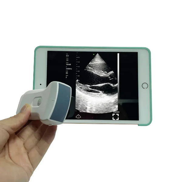 AMAIN Highest Cost-effective USB Double Probes Wireless  Scanner Ultrasound Probe