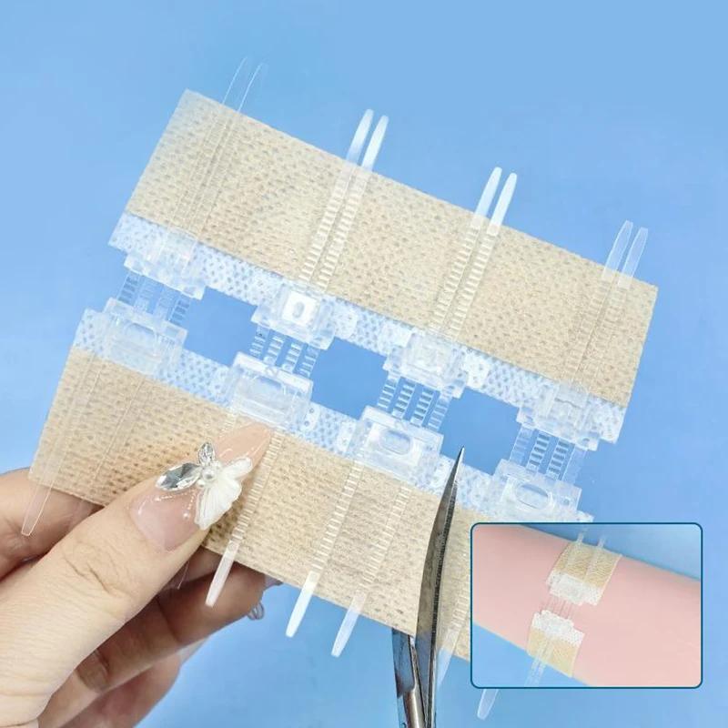 Zipper Tie Wound Closure Patch Hemostatic Patch Wound Fast Without Suture Zipper Outdoor Band-Aid Portable Quick Clot Wound