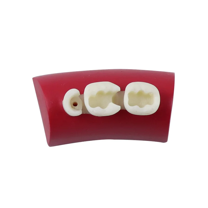 

Модель для упражнений с инкрустацией зубов, упражнения для наполнения блоков, модель для практики из смолы Typodont, модель для орального наполнения для стоматологии, обучающее исследование