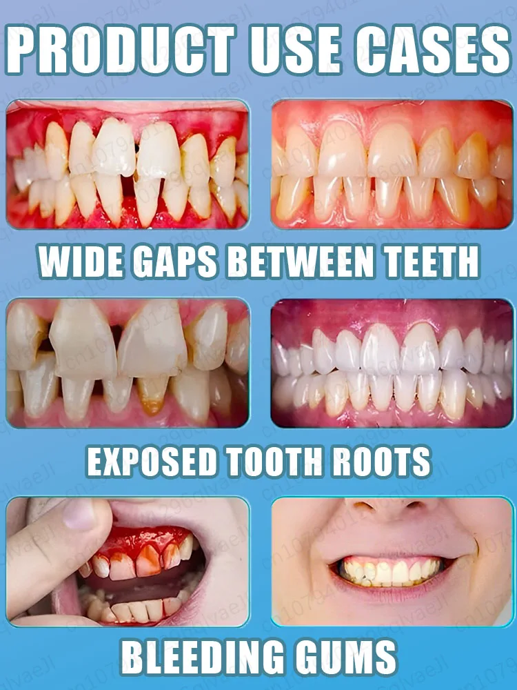 เอสเซนส์ป้องกันฟันผุ ฟื้นฟูเคลือบฟัน ซ่อมแซมฟัน เสริมสร้างความแข็งแรง ซ่อมแซมฟันผุ