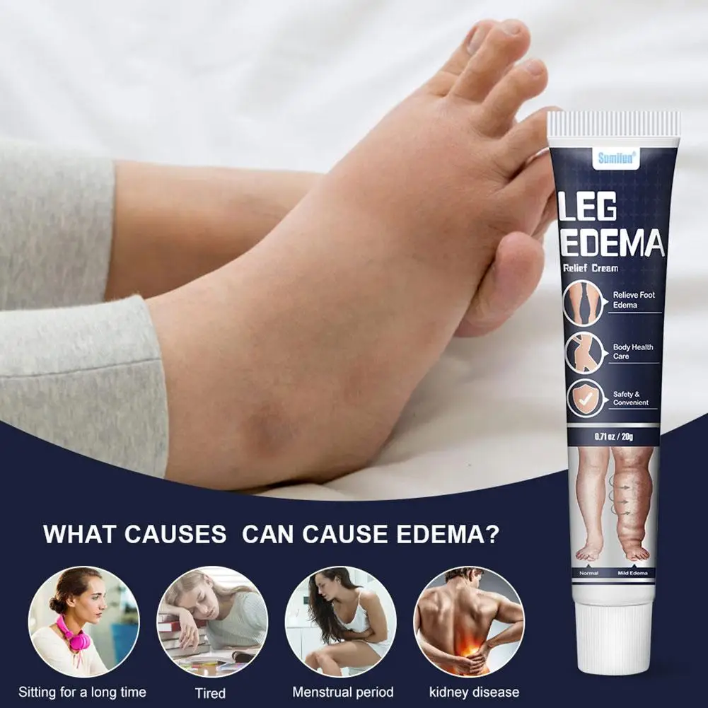 Crema per i piedi anti edema Massaggio ai piedi Crema sanitaria Alleviare efficacemente le vene varicose Braccio Gamba Gonfiore Dolore Crema rilassante