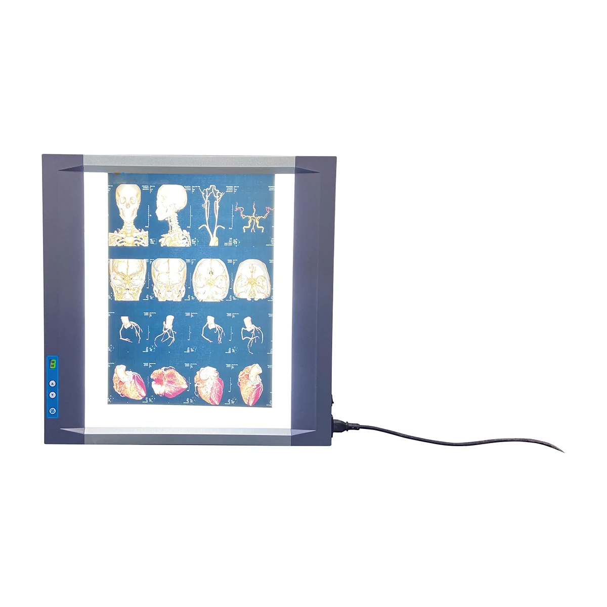 Led X-ray Viewer Illuminator Film Viewer Medical Portable Xray Radiology Negatoscope Triple Panels with Led Light Source