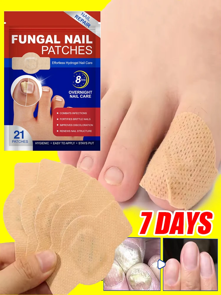 

Новые 21 шт. водонепроницаемые пластыри от грибка ногтей, корректирующие наклейки для восстановления вросших и поврежденных ногтей, серые пластыри для ухода за ногтями, инструменты для ухода за ногами