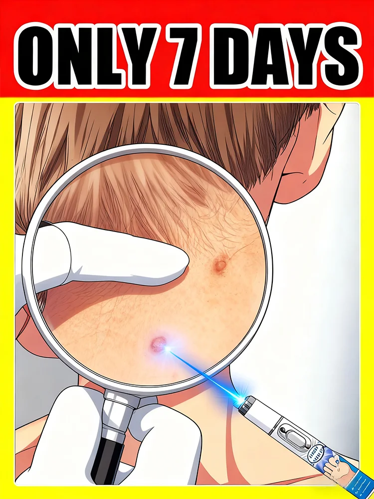 Outil Wart Blue Light, plus de réductions sur les ensembles