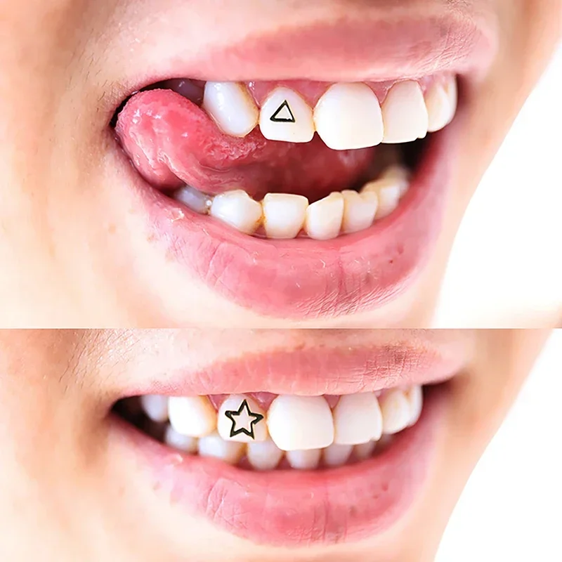 

3 PCS/Box Teeth Gems Tooth Jewelry Crystal Ornaments Fashion Teeth Charms Gems With Box Metal Dental Supplies Oral Decorations