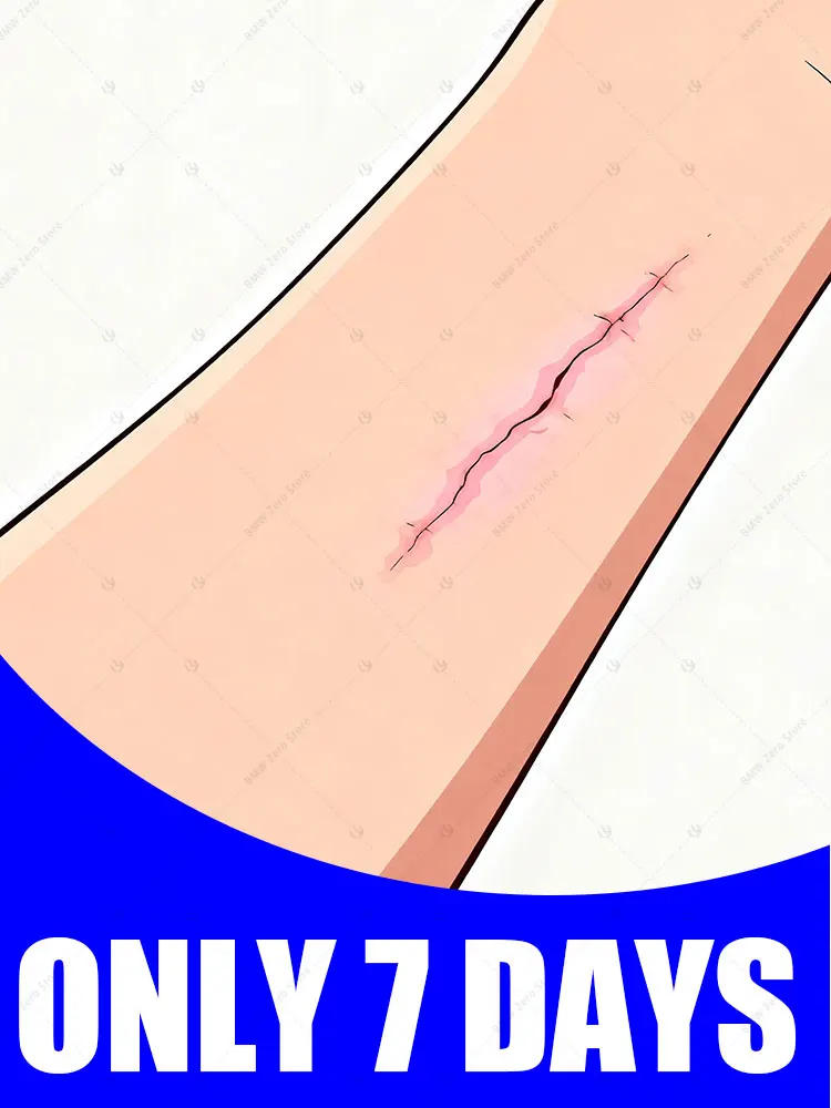 

Ручка с синим светом решает шрам, бестселлер в Азии.