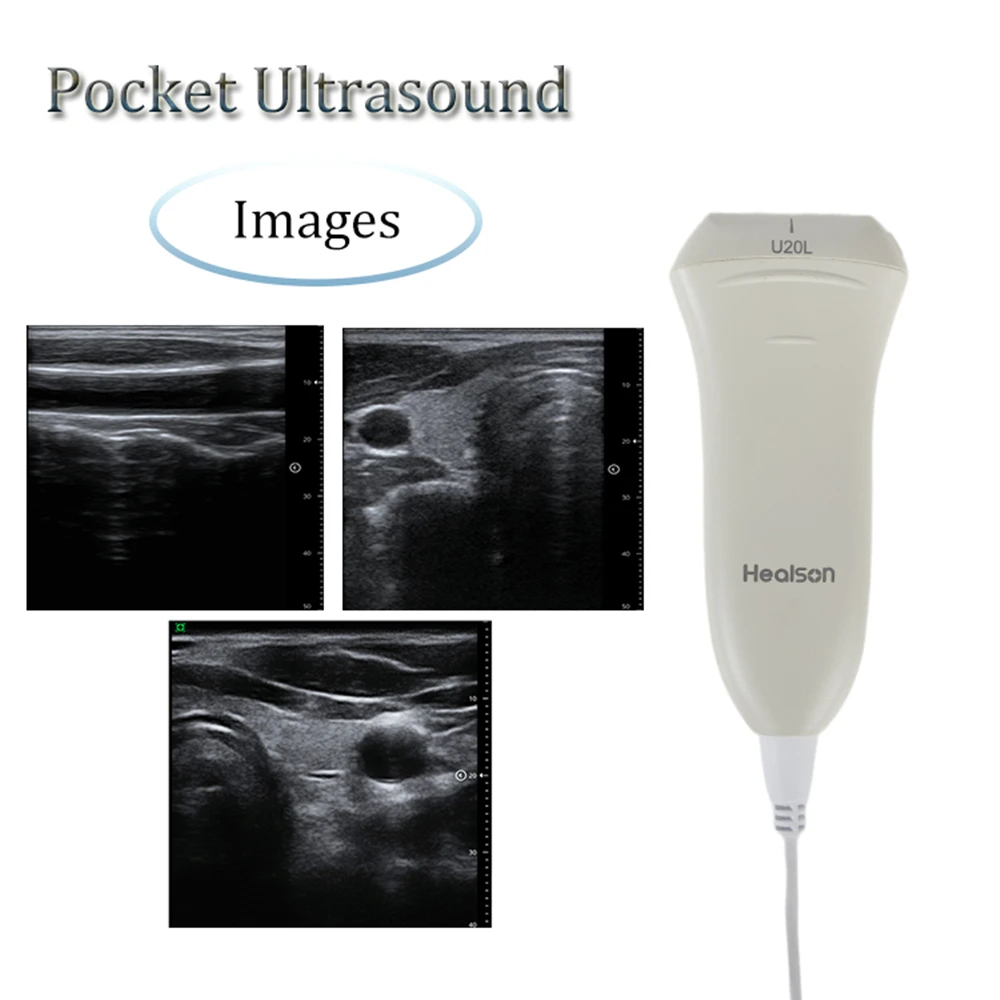 Healson Handheld Linear High-definition B Mode Probe Digital Ultrasound Portable USG Scanner Echo Machine for Superficial, MSK