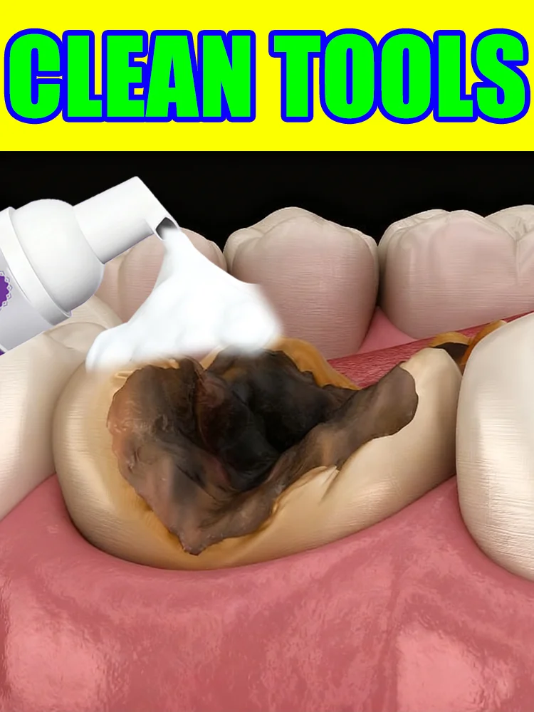 Herramientas de limpieza de Mousse intraoral, cuidado de Mousse de amor. Onda adiós al dentista