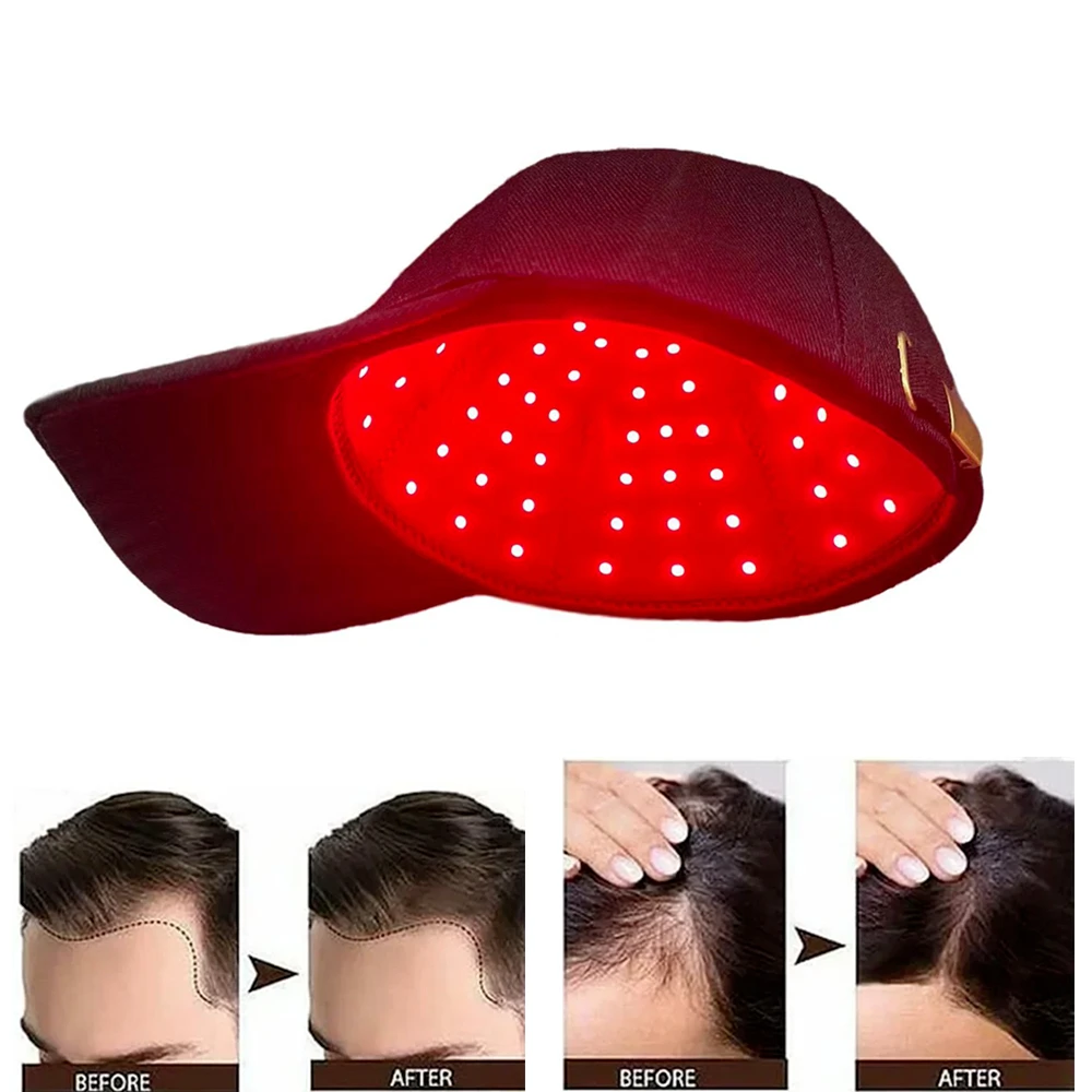 96 LEDs Lamp Beads Red Light Cap Hair Fast 660nm&850nm Infrared Light Regrowth Hat Red Light Device for Hair Loss Anti-hair