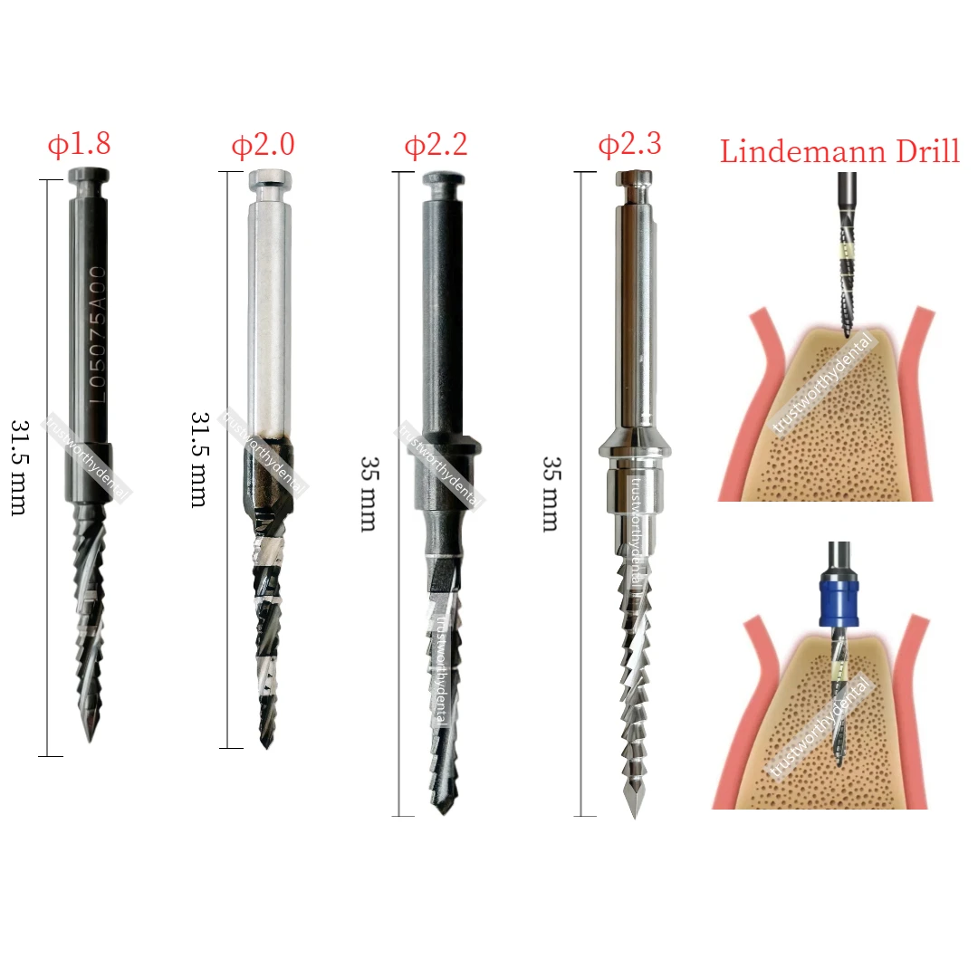 Dental Lindemann Drill Side Cutting Guide Drill First Guide Drill Second Implant Pioneer Bone Side Cut Blade Fit Denti SUPERLINE
