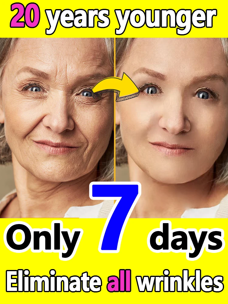 

20 years younger，Wrinkles disappear,Become beautiful now