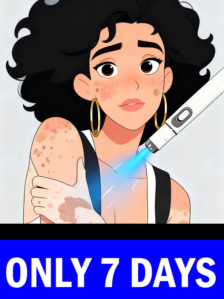 2025 Nueva herramienta de cuidado corporal Vitiligo Blue Laser care.