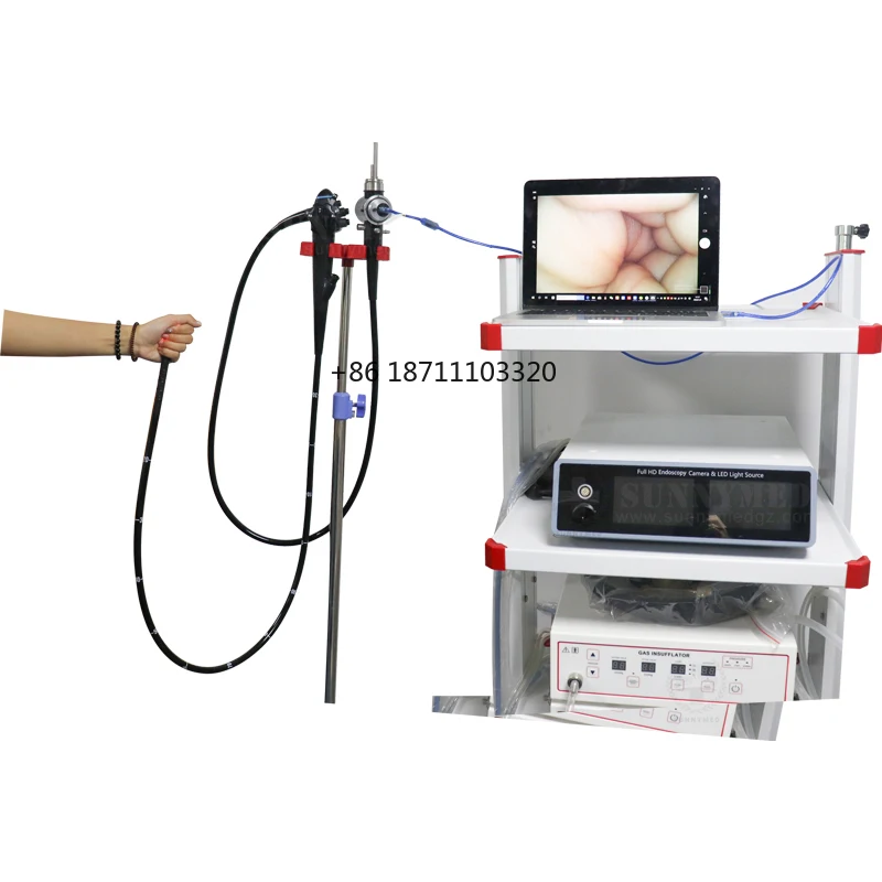 SY-PG045 Medical Trolley Video Endoscope Gastroscope Vet Endoscopic Imaging System Gastroscope Pet Hospital Endoscopy Machine