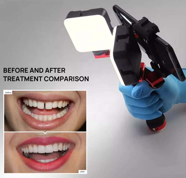 Private Label LED Photographic Holder for Twin Flash Photography Easy Installation Electric for Dentist Mobile Phone Oral Care