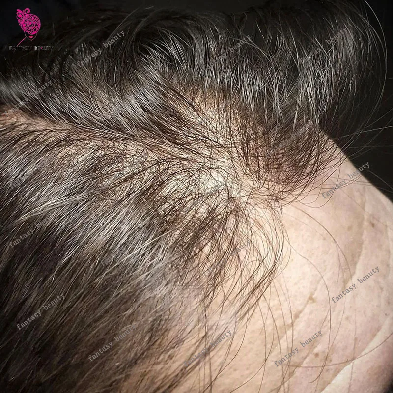 خط شعر طبيعي غير قابل للاكتشاف 0.02 مللي متر بشرة رقيقة جدًا 80% كثافة شعر للرجال شعر بشري حقيقي نظام صناعي شعر مستعار بني
