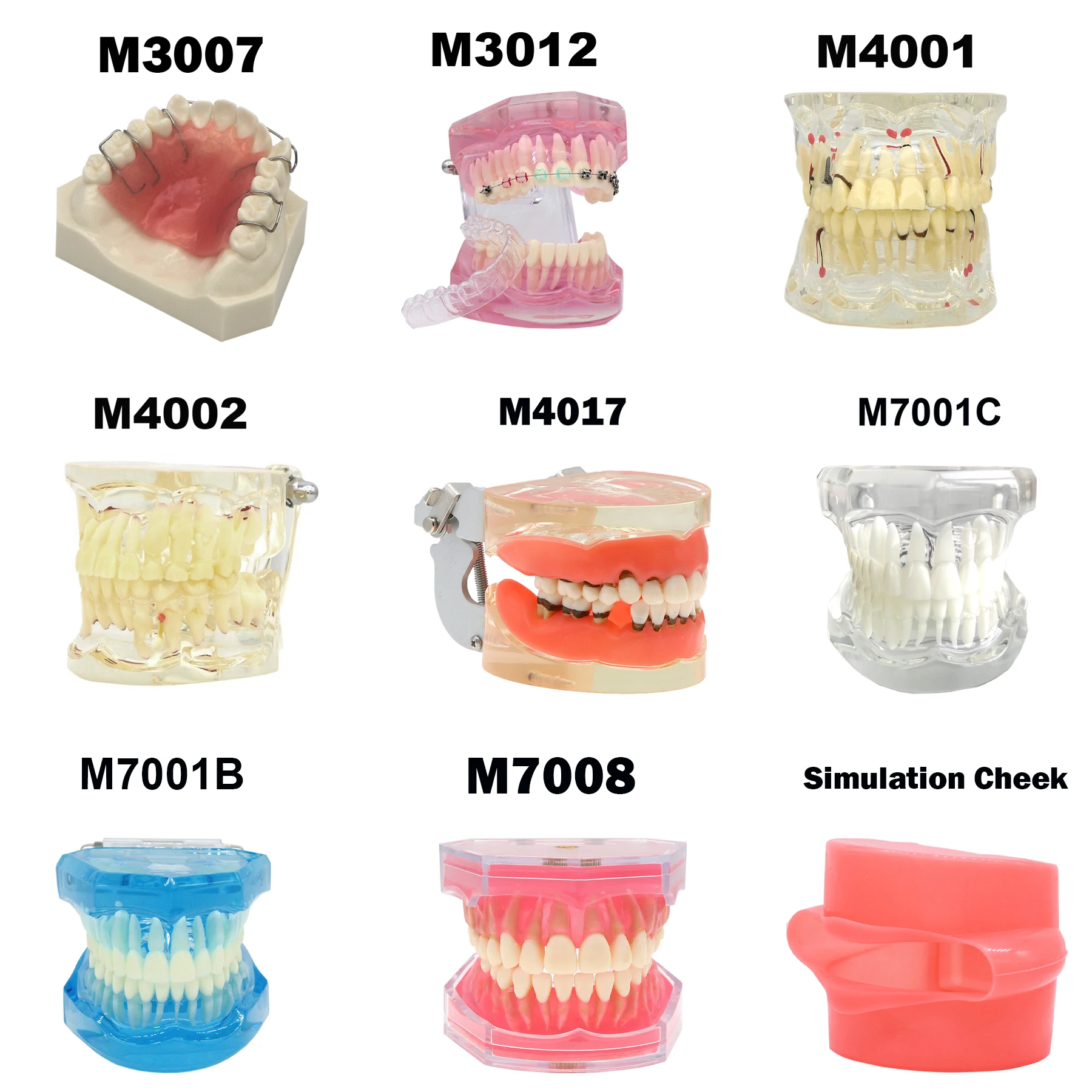 Modelo de implante de dentes dentários, vários tipos, modelos de ensino de odontologia, ortodôntico removível para educação de pacientes, demonstração