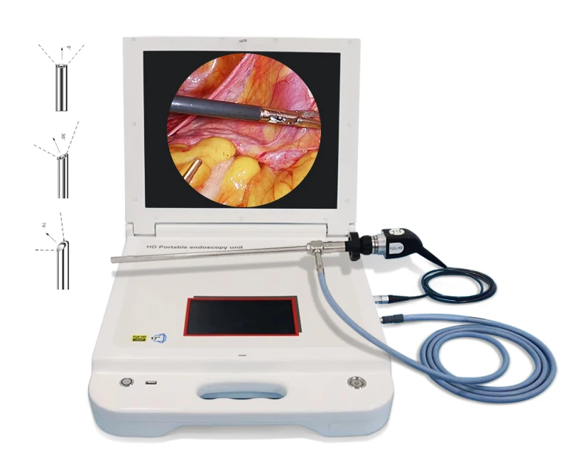 for Rigid EndoscHD Portable ENT All-in-One 1080P Endosco Camer System