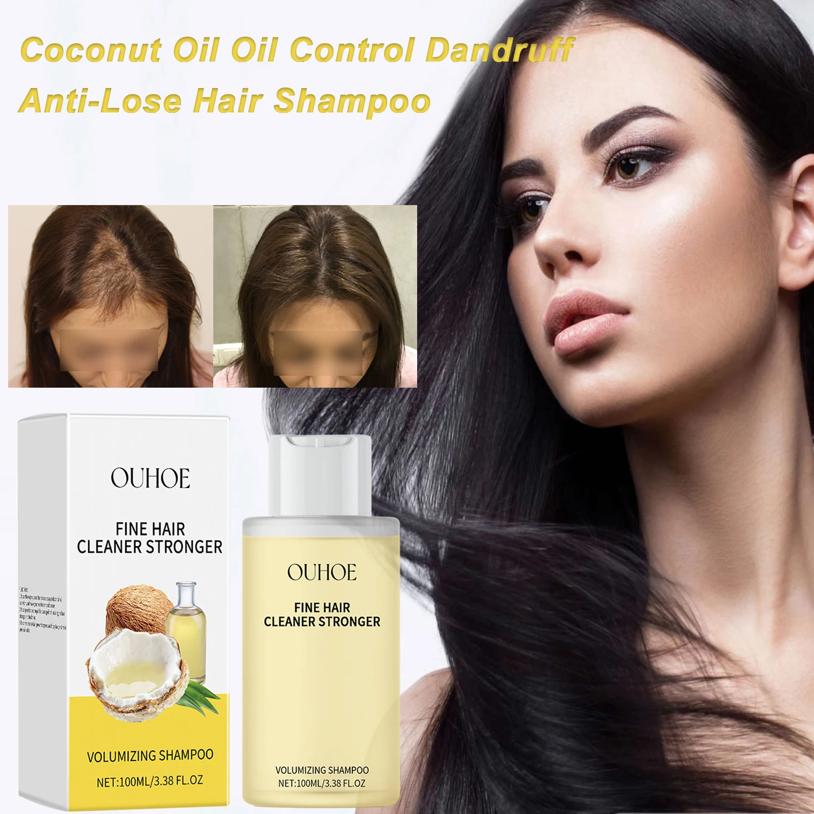 

V-оливковый шампунь для волос, мягкое кокосовое масло, освежающий контроль жирности, лупа, очистка кожи головы, восстанавливающий кератиновый шампунь, уход за волосами