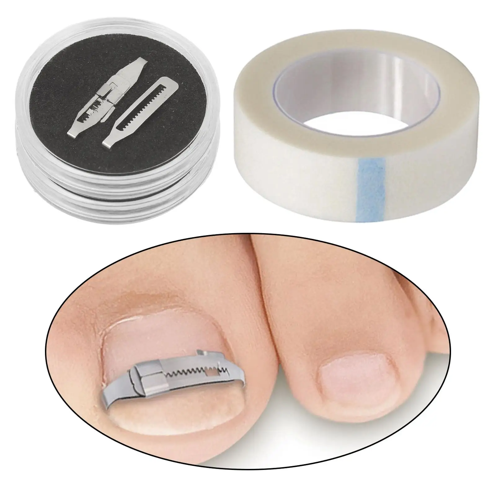 أدوات مصحح أظافر القدم الغارزة المهنية تضمين علاج أظافر القدم