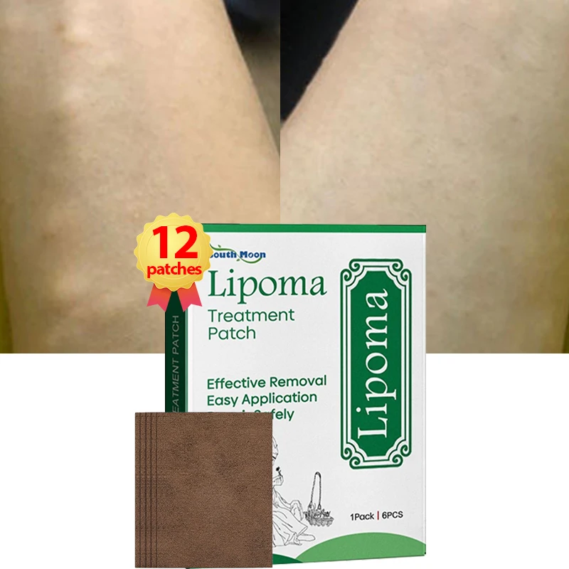 

Lipoma Remover Patch Fat Mass Treatment Solitary Multiple Lipoma Scyst Fat Lump Fibroma Cellulite Removal Hua Tuo Medicine