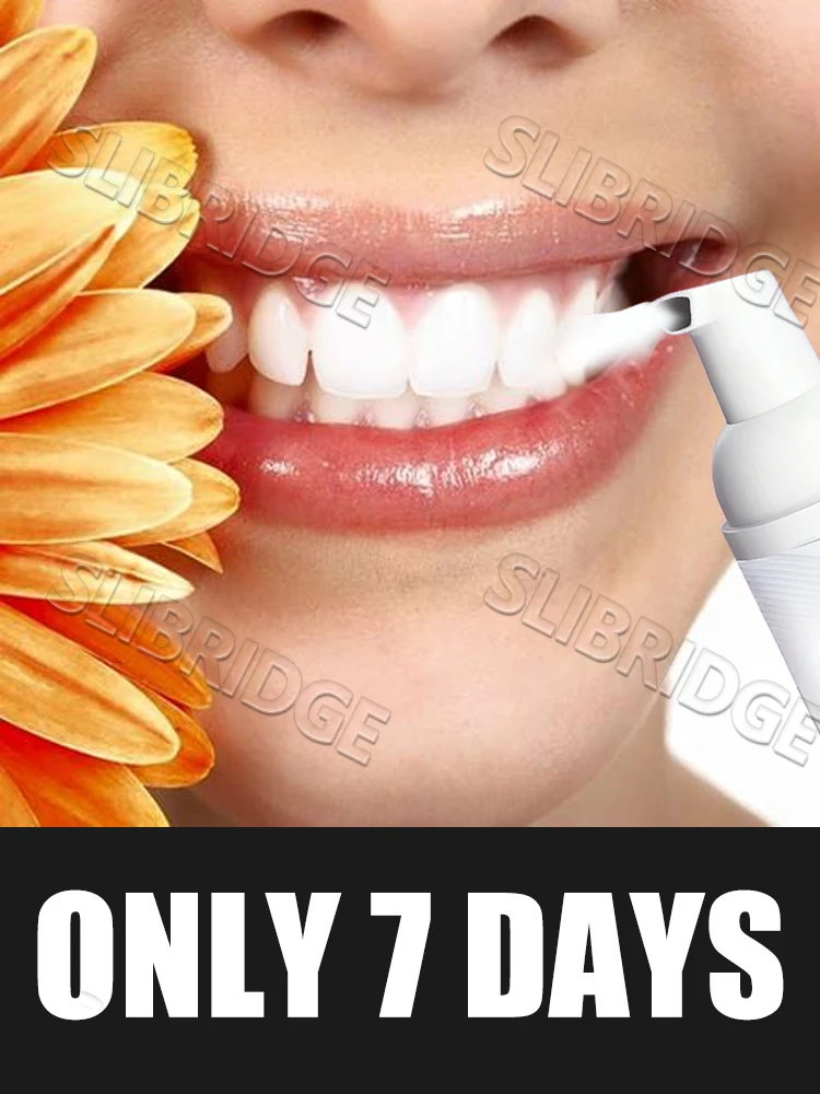 Hot Sale New Upgrade Cleaning Intraoral Tools Foam Cleaner Intraoral Mousse tool,2025