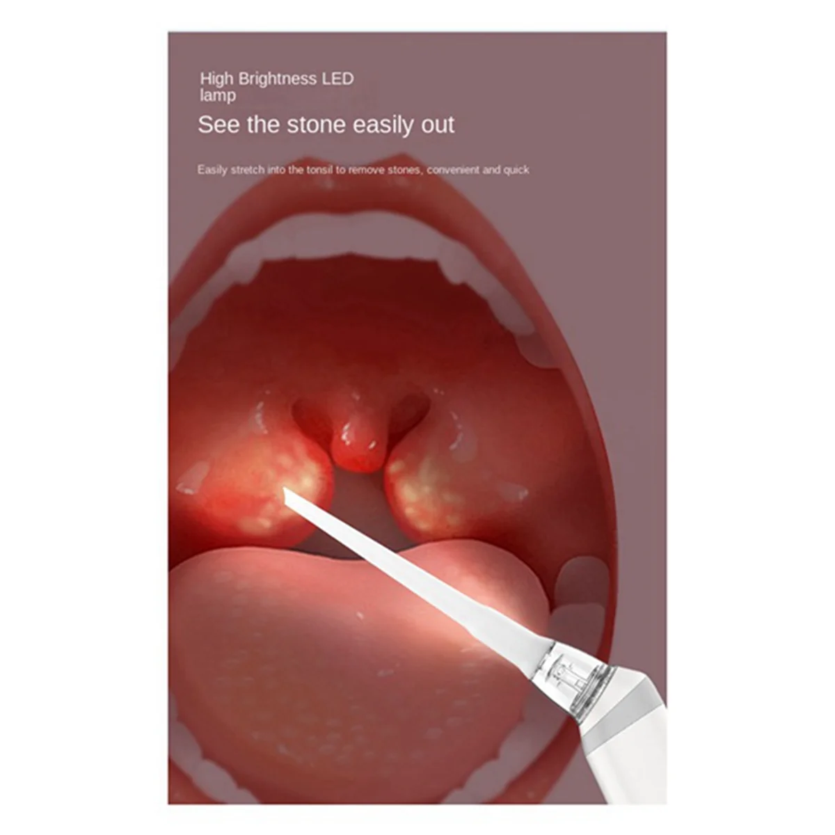 Elektroniczny zestaw do usuwania kamienia migdałkowego, odkurzacz do usuwania kamieni migdałowych, automatyczny środek do czyszczenia jamy ustnej,