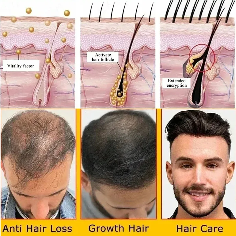 Soro de crescimento rápido do cabelo para homens e mulheres, anti-perda, cabelo rebrota produtos, reparação danificado cabelo raízes, cuidados com o cabelo, 7 dias, Batana