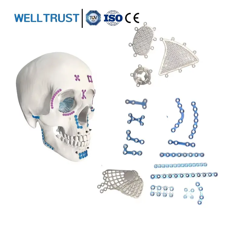 Surgery Implants Maxillo Facial Plaque And Maxillo-facial Screws 2.0 Imf 1.5mm Maxilofacial Titanium Mini Maxillofacial Plates