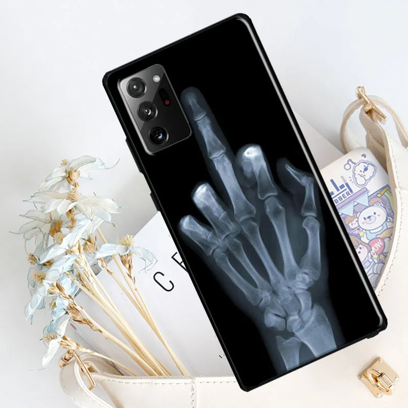 X-ray Hand Bones Silicone Case For Samsung Galaxy S23 S8 S9 S10 S20 FE S21 Plus Note 20 Ultra S22 Ultra Cover