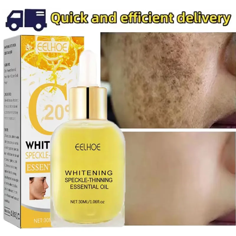 

Vitamin C Whitening Freckles Serum Nicotinamide Remove Dark Spots Freckles Fade Melanin Essence Brighten Moisturizing Skin Care