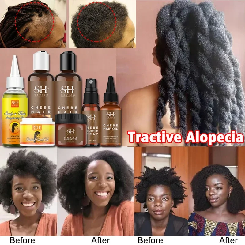 

Chebe Powder Shampoo Anti-Hair Loss Spray Get Rid of Wigs Africa Women Traction Alopecia Treatment Hair Growth Product for Men