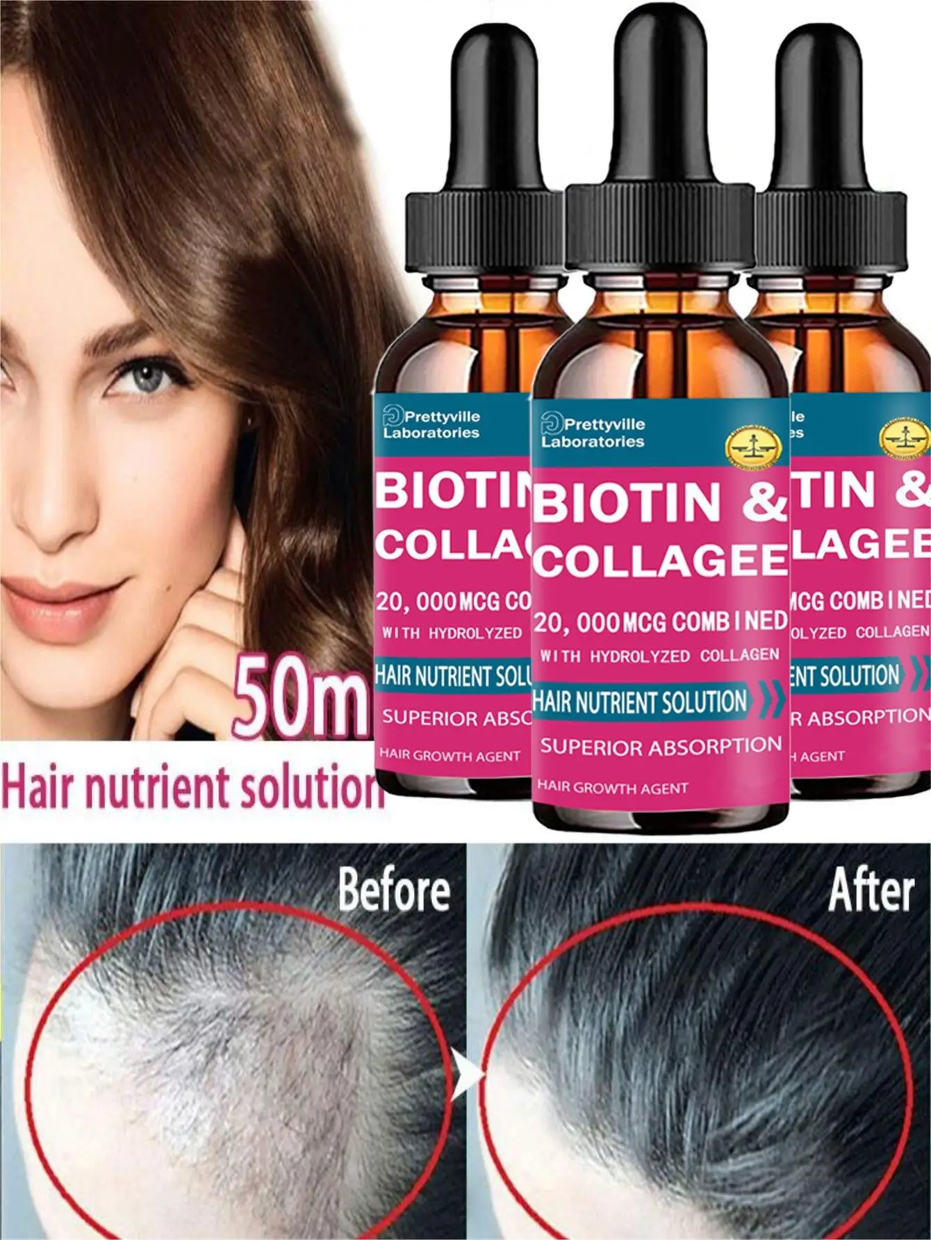 Hairloss Hair Alopecia Hair Treatment for Black Women Growth Oil Head Care Growth Spray